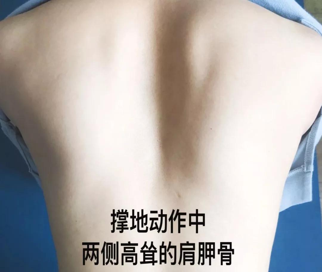 肩膀嘎吱嘎吱响，是何原因？如何解决？