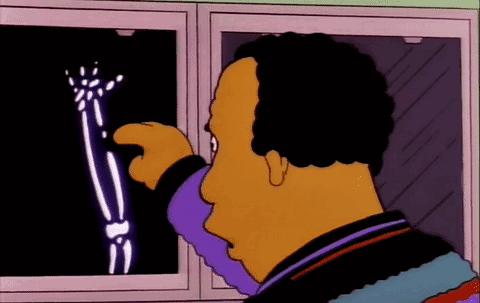 学生掰手腕致骨折原视频,学生掰腕子骨折视频