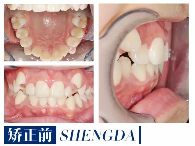 山西“爱马仕”级别齿科医院!get明星同款笑容