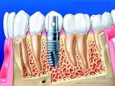 helen榻跨,Helen榻跨涓績
