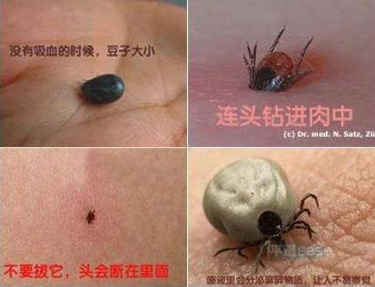 去头发虱子与虱子卵最有效方法,去除头上虱子和虱子卵最好小窍门