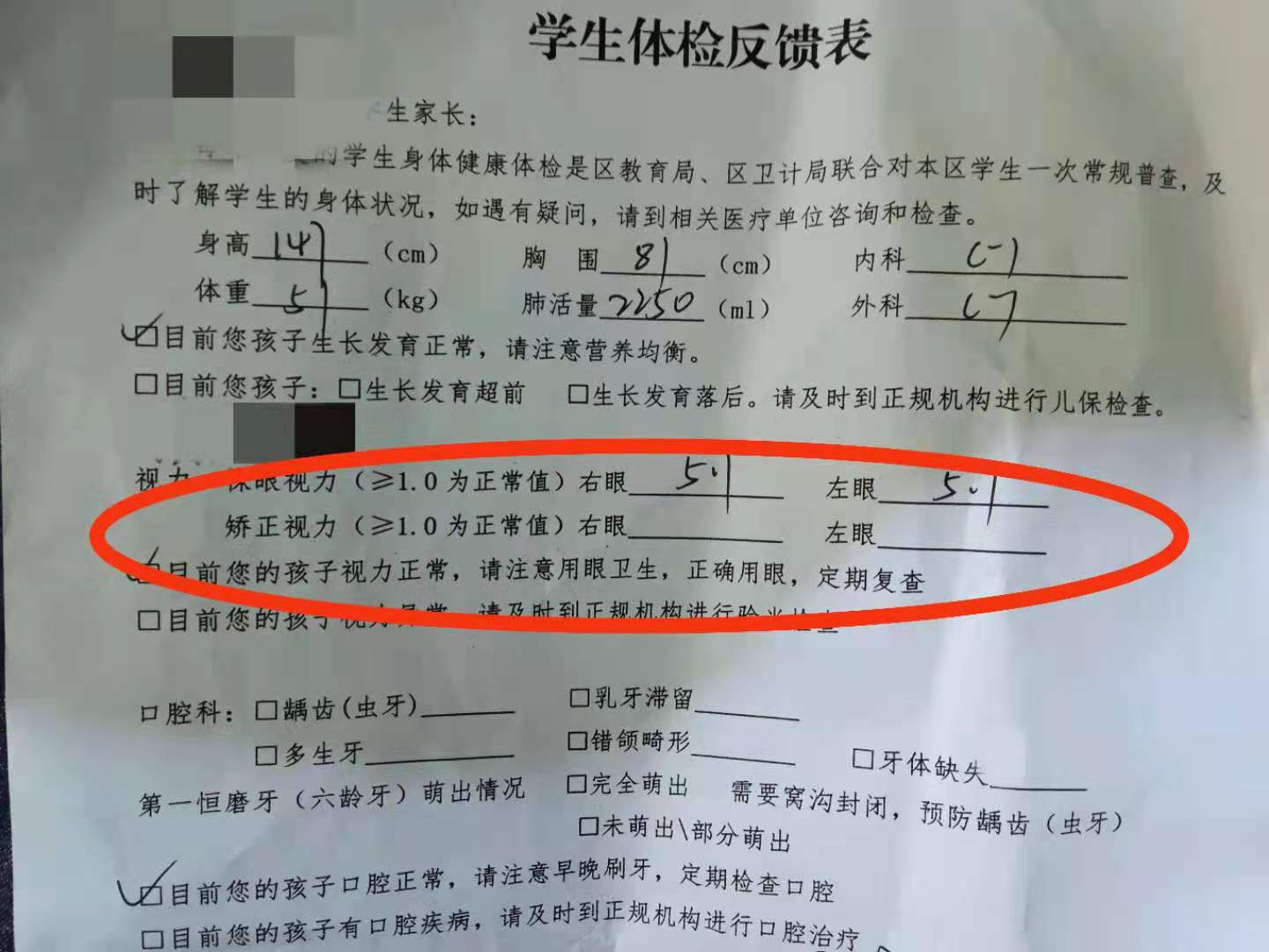 小孩子近视了一定要戴眼镜吗,小孩近视一定要戴眼镜吗