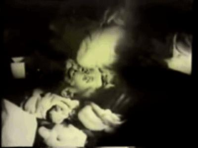 83天痛不欲生的活体腐烂，他在一次核事故后缓慢死去