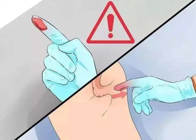 医生为什么要摸肚子,为什么医生会用手摸脖子