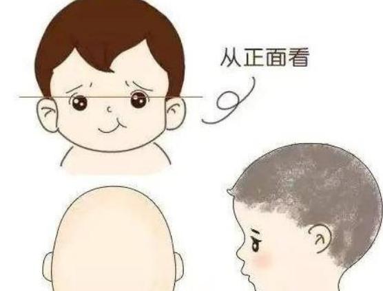 小孩后脑勺很平有什么影响吗,小孩后脑勺尖是否聪明