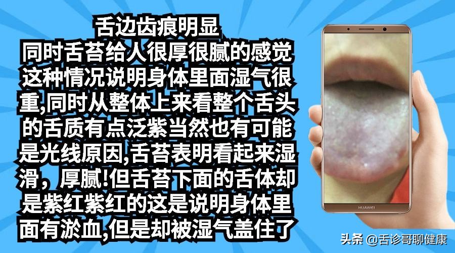 抖音舌诊哥,舌诊哥视频