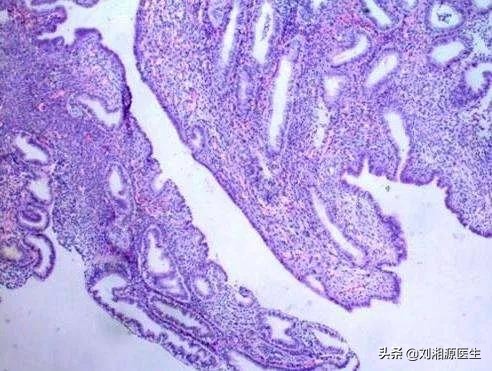 免疫不良妊娠可以通过中药治疗吗,免疫相关不良妊娠答疑解惑