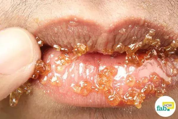 蜂蜜加白醋有哪些用途,白醋加蜂蜜真有这么好吗