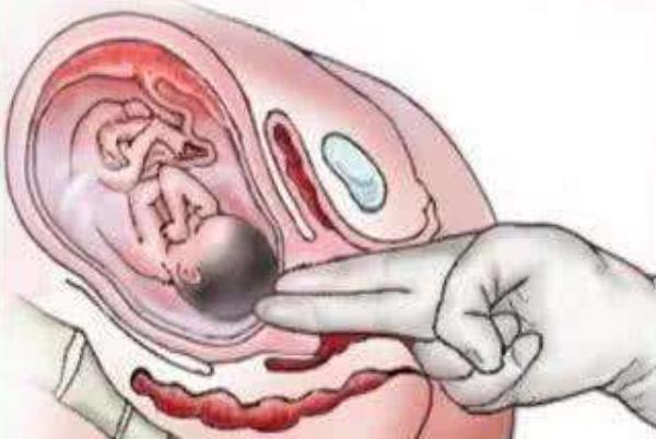 孕检遇见男医生有多尴尬,孕检什么时候需要内检