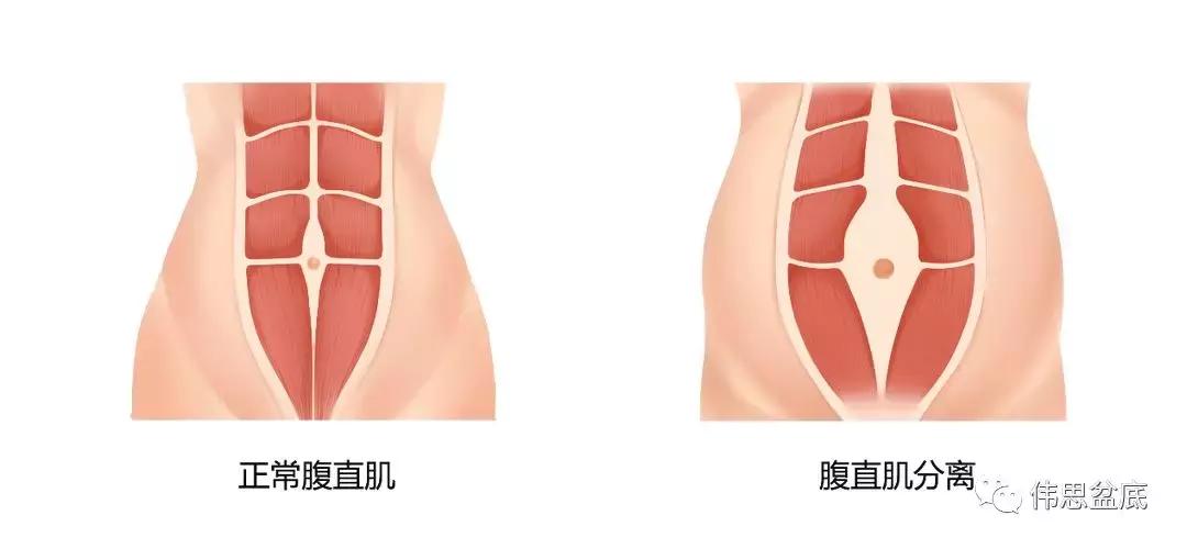 生完孩子后悔了怎么办,每次生完气又后悔