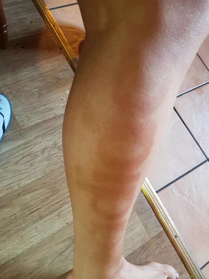 英国女子穿阿迪达斯打*裤底**晒出商标,申请当品牌代言人惨遭拒绝