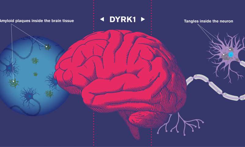阿尔茨海默病新突破,阿尔茨海默症的研究成果
