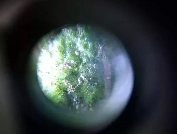 柑桔砂皮病哪个时间最易爆发,柑橘表皮有疙瘩怎么治疗