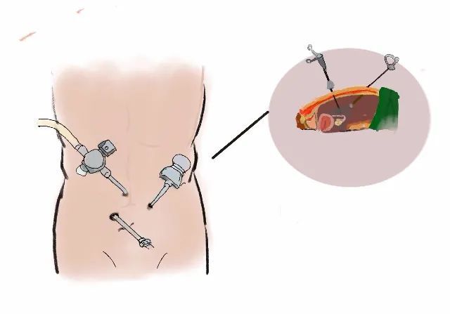 那个女孩失血过多危在旦夕，她的家人却在急诊室喜极而泣…