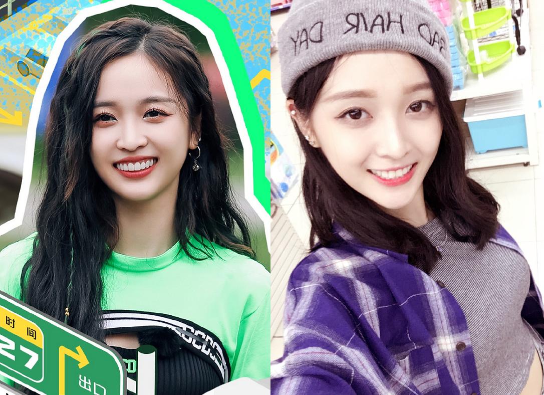 李佳琦牙齿是烤瓷牙吗,李佳琦以前和现在牙齿对比