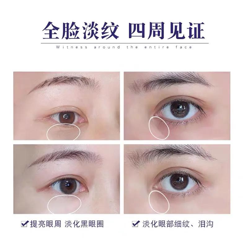 欧莱雅紫熨斗眼霜价格是多少,欧莱雅紫熨斗眼霜为什么搓泥