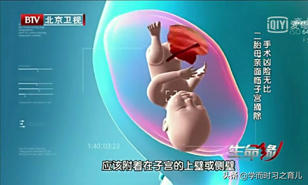 孕早期怎么知道是前置胎盘,孕早期能看出前置胎盘吗