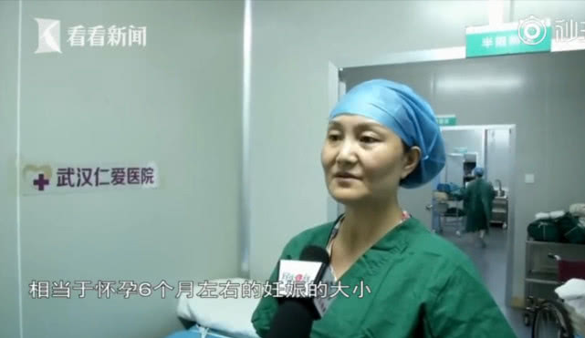 女子未婚先孕肚子突然变大,女子怀孕10个月不生孩子重达50斤