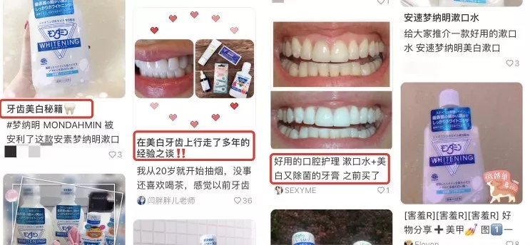 刘涛是全口瓷牙,演员刘涛的一口烤瓷牙多少钱