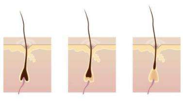 毛囊堵塞导致的脱发怎么办,额头油脂分泌旺盛毛囊堵塞脱发