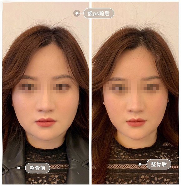 小颜整骨瘦脸手法,小颜整骨瘦脸视频