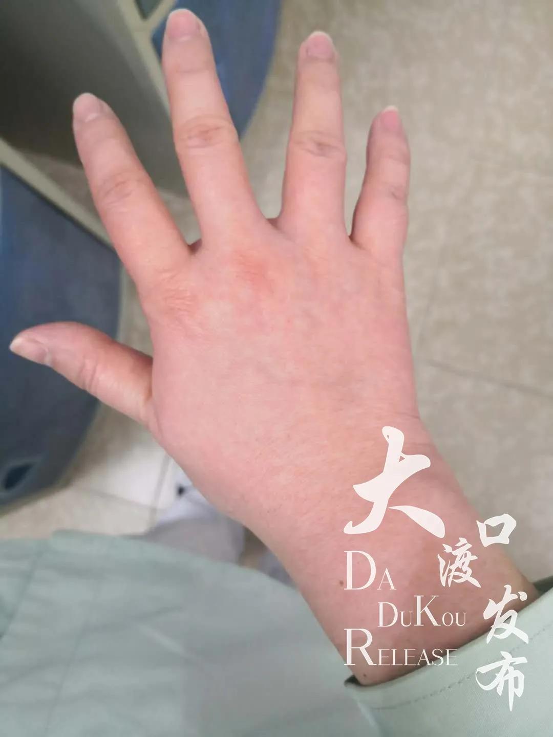 重钢总医院照片,重钢总医院五楼