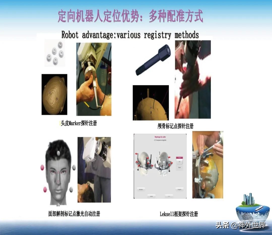 宣武医院神经外科王亚明祖籍,北京宣武医院神经科专家王亚明