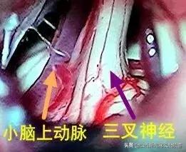 长治市和平医院能做减压手术吗,长治市和平医院动脉介入手术