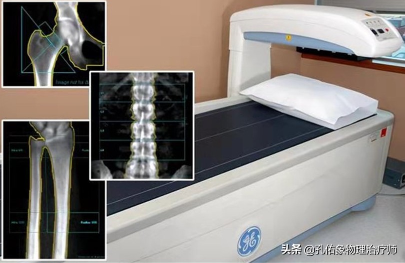 50岁更年期女性补钙的正确方法,50岁左右的女性出现各种疼痛