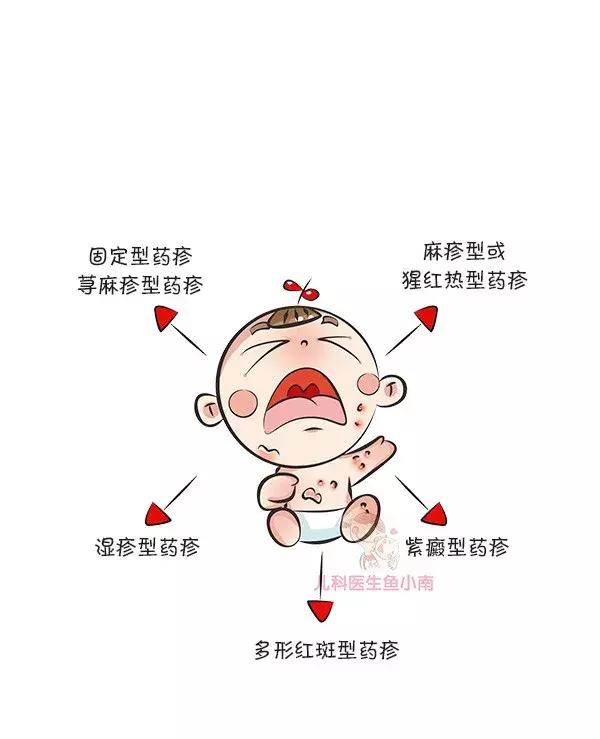 热疹皮疹湿疹有什么区别,湿疹和荨麻疹有什么区别怎样判断