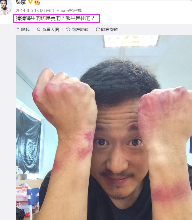 吴京全身缝针,吴京全身缝针高达100多针