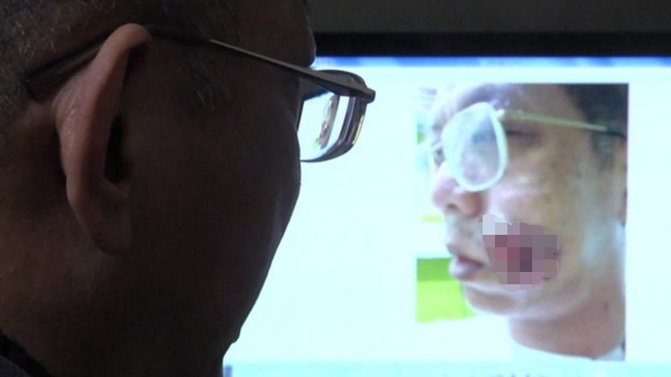 槟榔到底害了多少年轻人,槟榔危害性有多大安全性又有多大