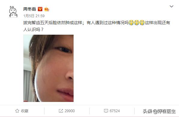 你要拔智齿吗,拔智齿注意事项与禁忌牙周炎