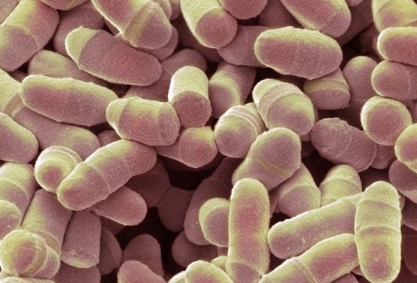 敏感肌选兰蔻小黑瓶还是雅诗兰黛,皮肤有问题可以用的粉底液