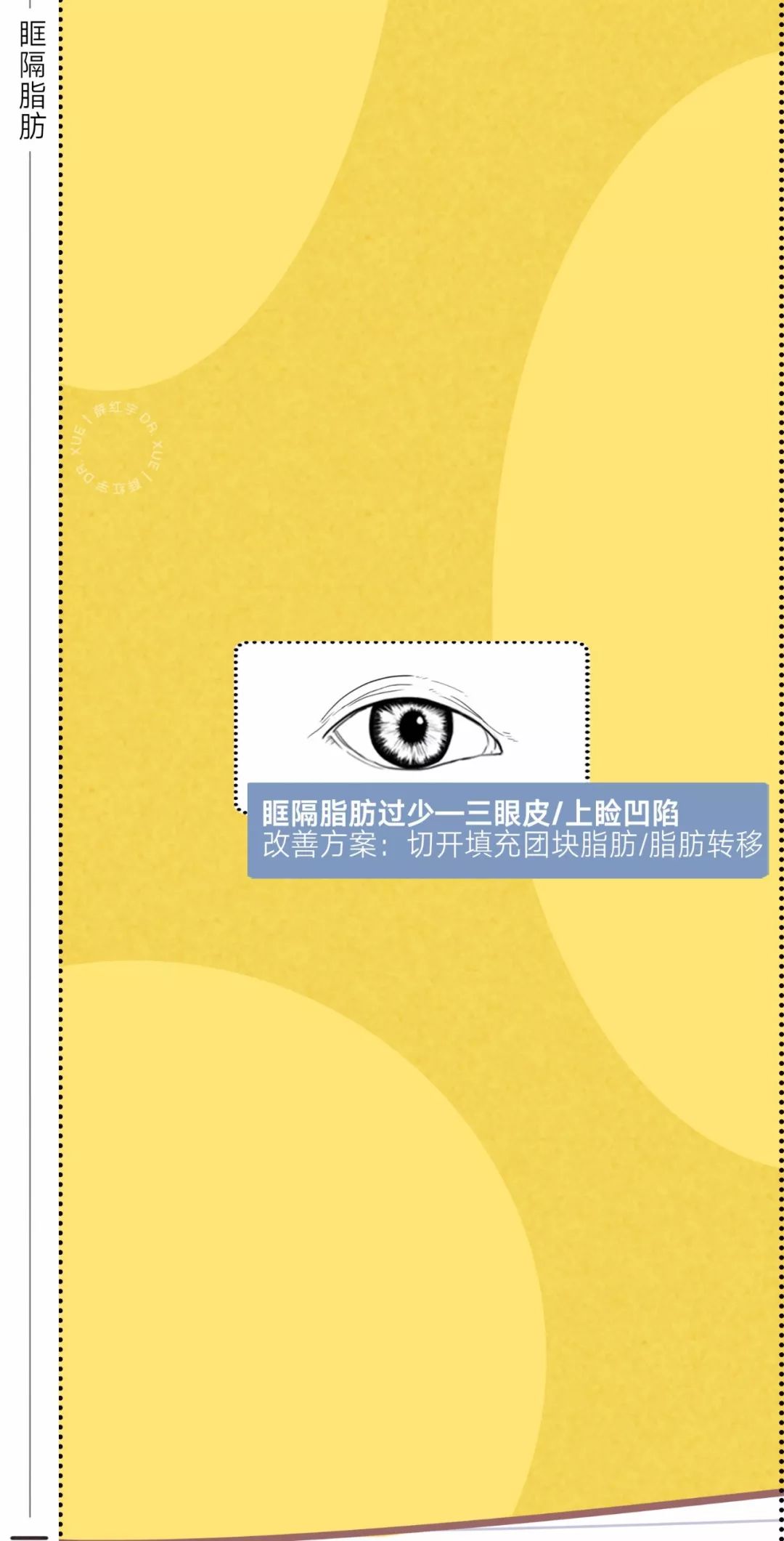 眼睛种类图解漫画,漫画眼睛的几种形态