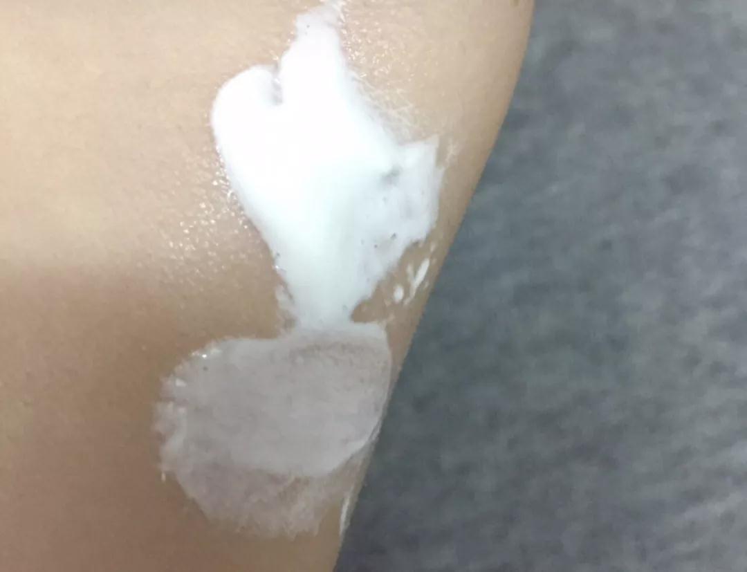 维生素abce分别有什么用,维生素abc是拿来干嘛的