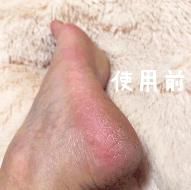 爽炸了！干丑裂的脚皮，一张完整撕掉，敢跟婴儿比姣嫩！