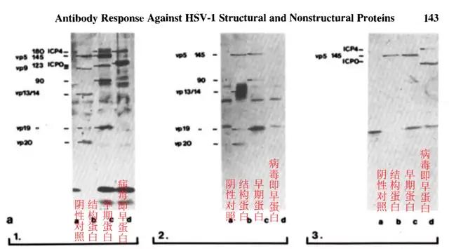 hsv干扰免疫应答及抗原选择,hsv病毒培养