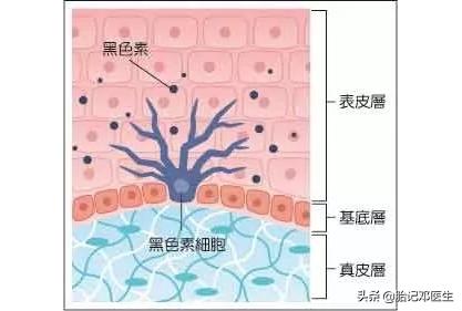 太田痣彻底治愈的效果,太田痣什么时候治疗最合适