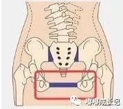 做骨盆修复是交智商税？