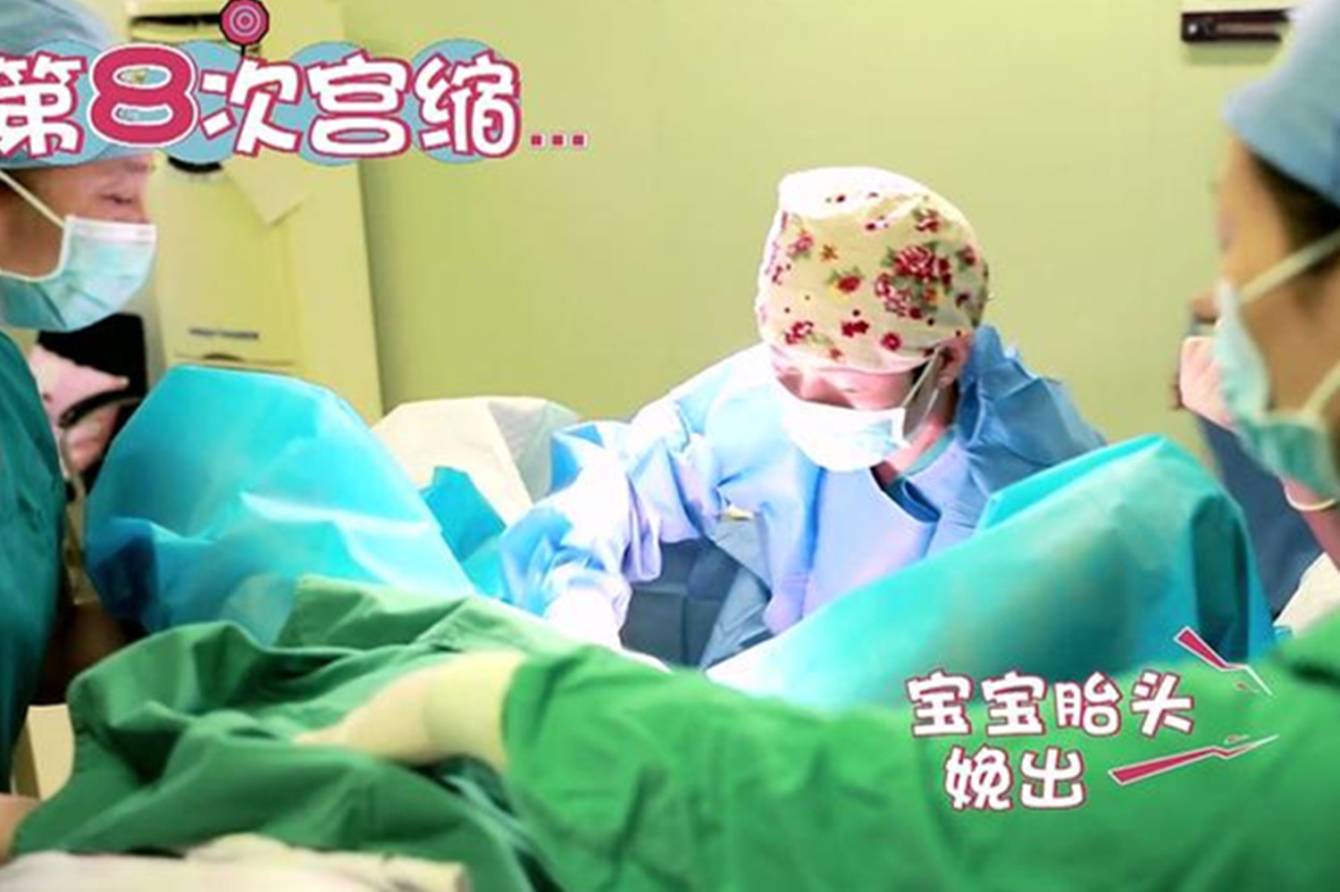 顺产撕裂伤口会影响大便吗,顺产撕裂会影响以后生活吗