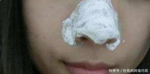 满婷除螨皂去黑头,美容除螨去黑头