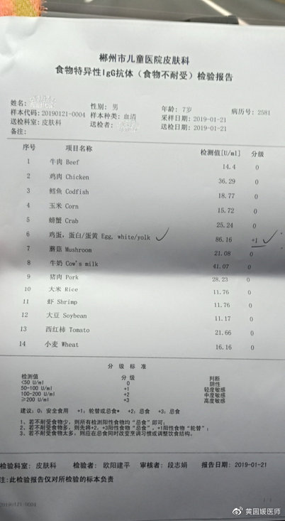 孩子长不高很瘦吃什么钙片,长不高缺钙应该吃什么