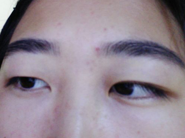 sizzix日本双眼皮定型霜,双眼皮定型霜怎么归类