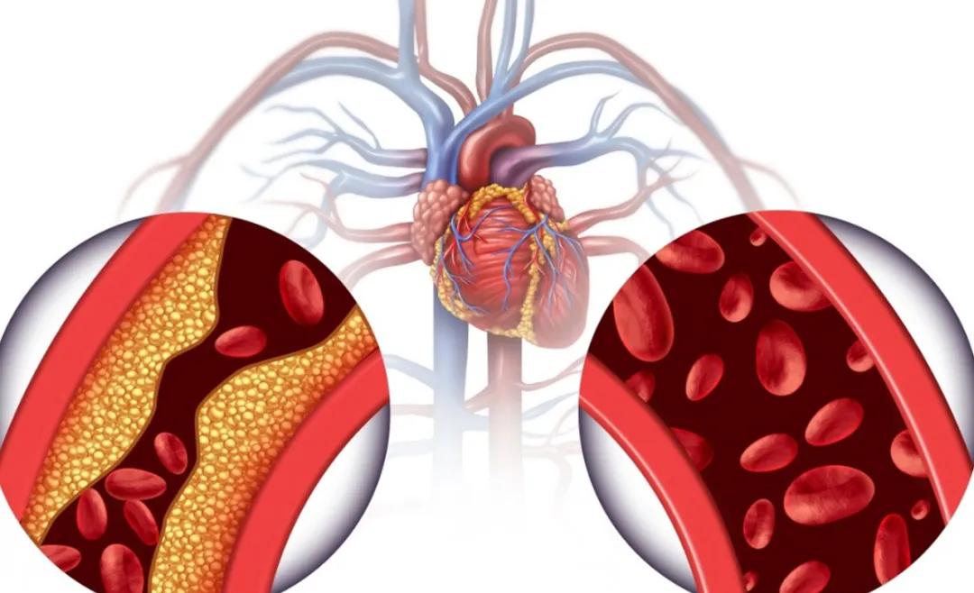 癌症晚期呼吸衰竭心衰还能活多久,癌症晚期出现心衰嗜睡能活多久