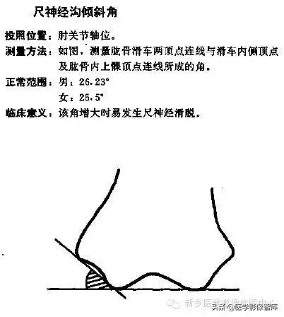 肘关节x线测量,肘关节骨骺示意图