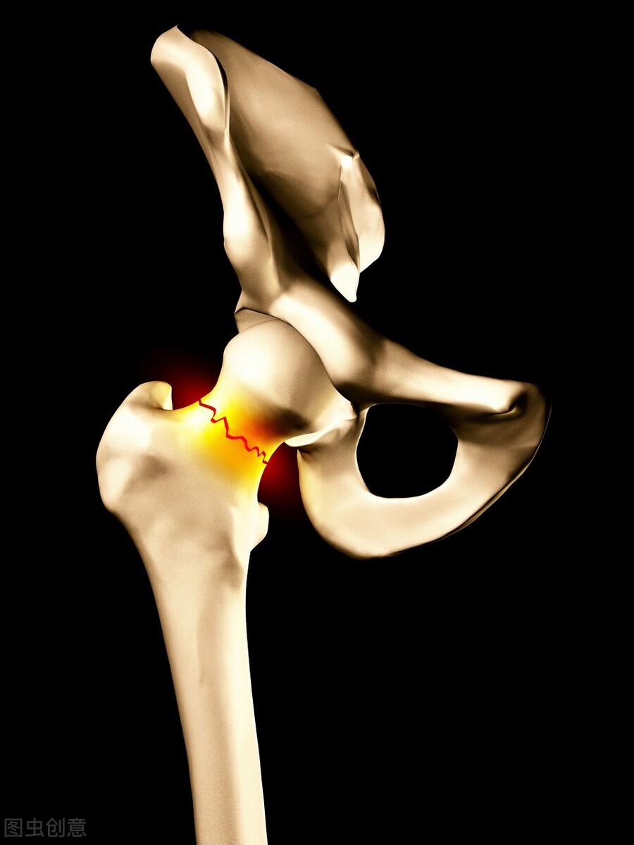 骞煎効鑳宠唺楠ㄦ姌鎬ユ晳瑙嗛,鑵版楠ㄦ姌鎬ユ晳瑙嗛鏁欑▼
