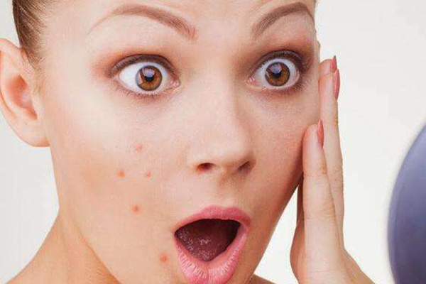 祛痘痘的最有效的食物,改善痘痘应该吃什么