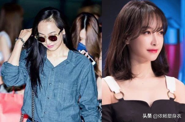 发际线高怎么挽救男生头发,怎么防止发际线后移秃头