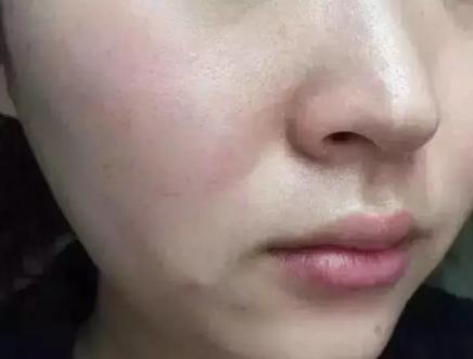 总算为国货争了口气，98.21%除螨率的洗面奶，张馨予也爱用